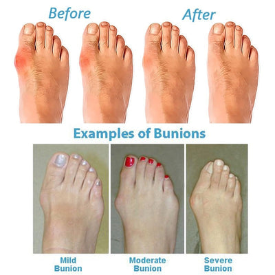 Myna - Comfortable Orthopedic Sandals